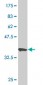 PKP4 Antibody (monoclonal) (M02)
